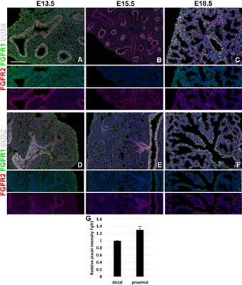 Temporospatial Expression of Fgfr1 and 2 During Lung Development, Homeostasis, and Regeneration